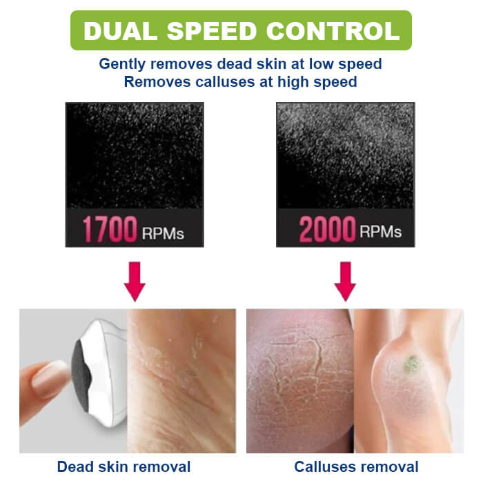 SoftFeet™ Elektrische Fußfeile