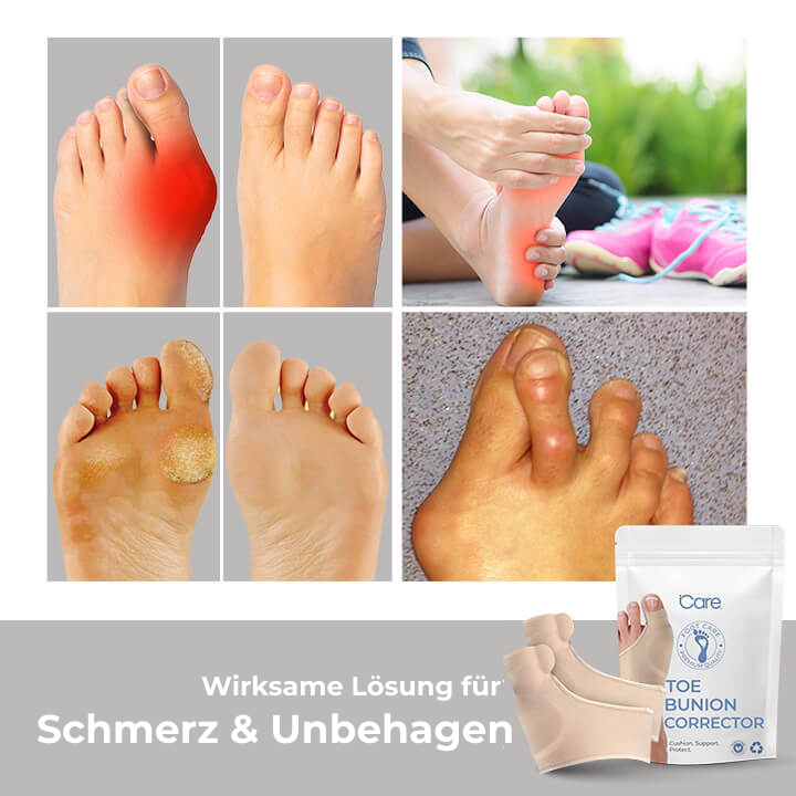 BunionCare® Orthopädischer Hallux valgus-Korrektor 1+1 GRATIS!
