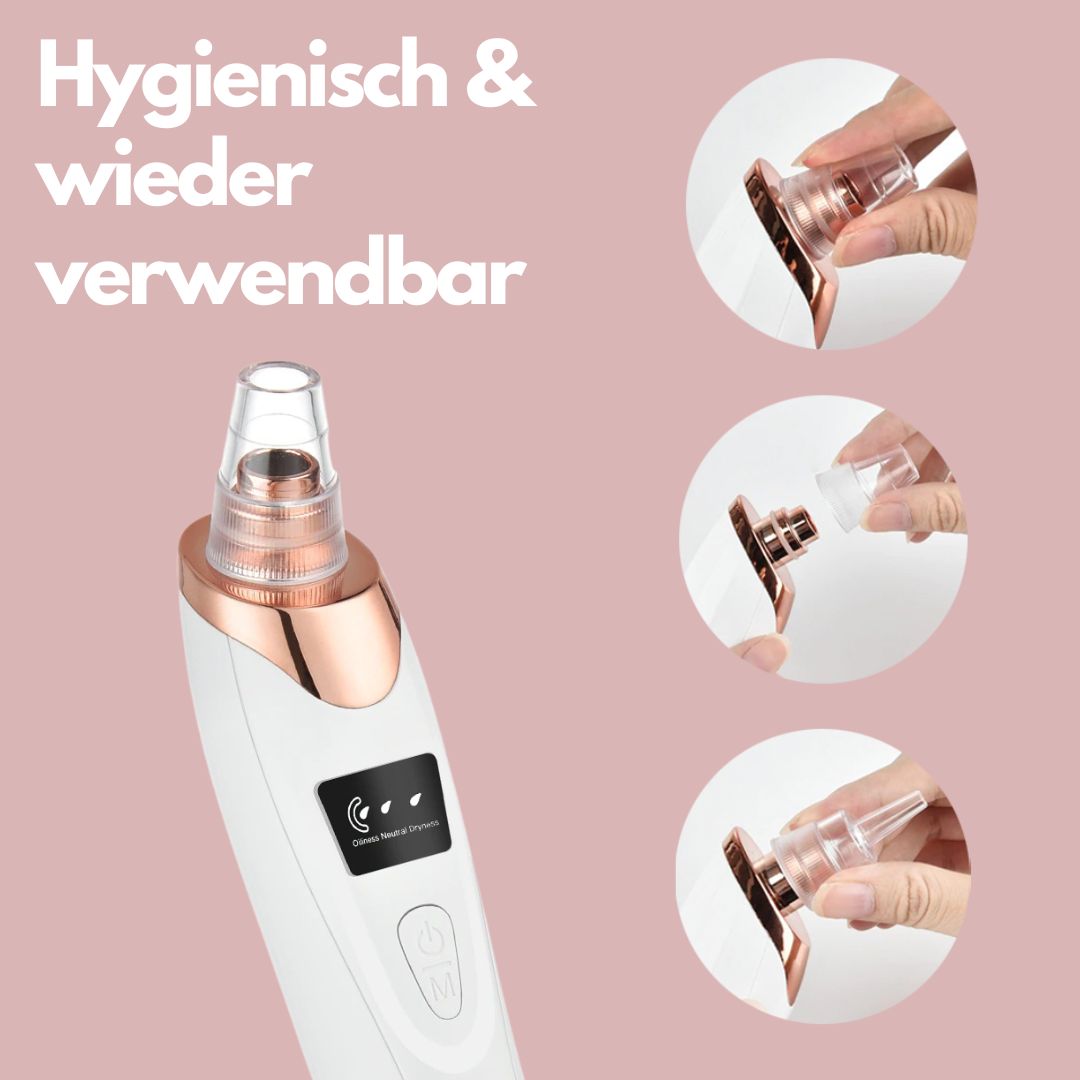 SkinSpa™ Mitesser-Entferner