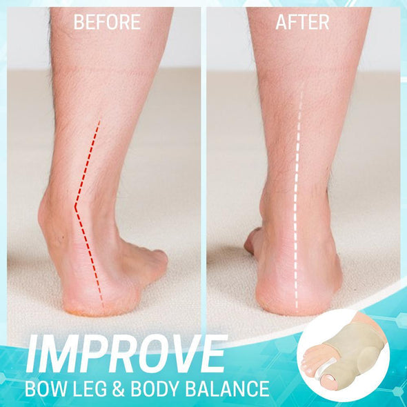 Dr.Healthy Ballenzeh-Korrekturhülse