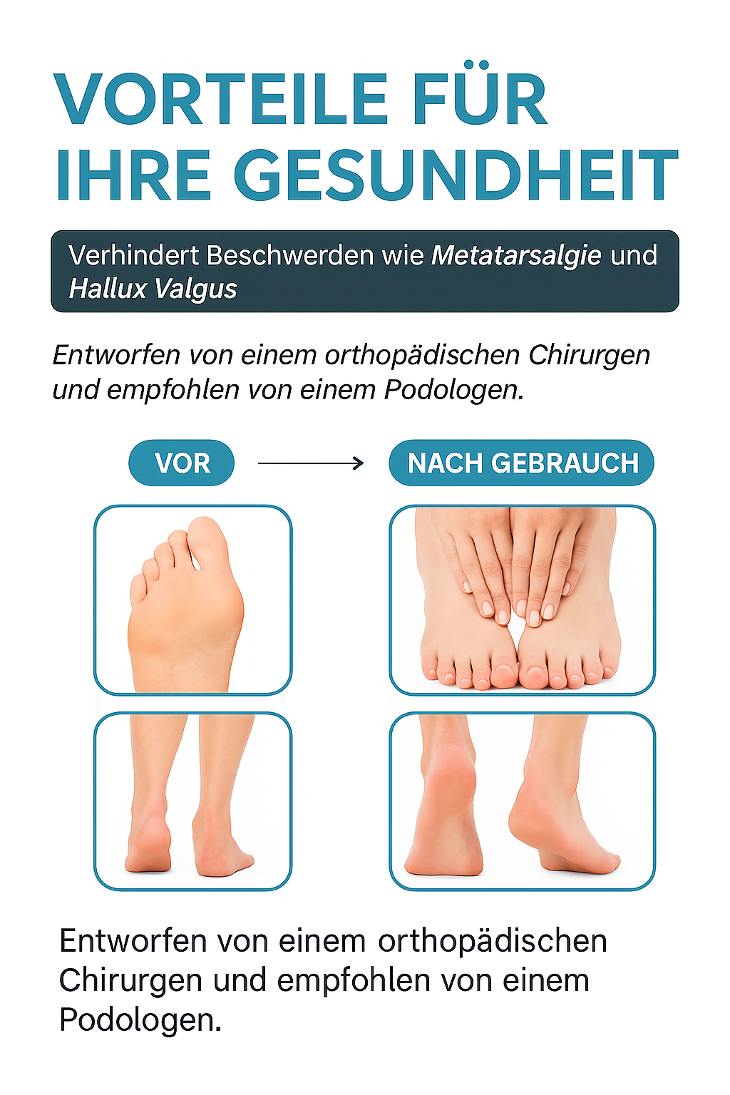 FußLiva™ | Bequeme Gel-Pads mit Zehenspreizern – 1+1 GRATIS