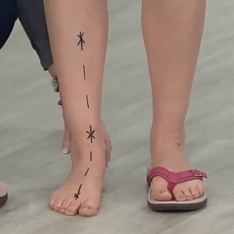 Ellendor's Orthopädische Sommersandalen (50% Rabatt)