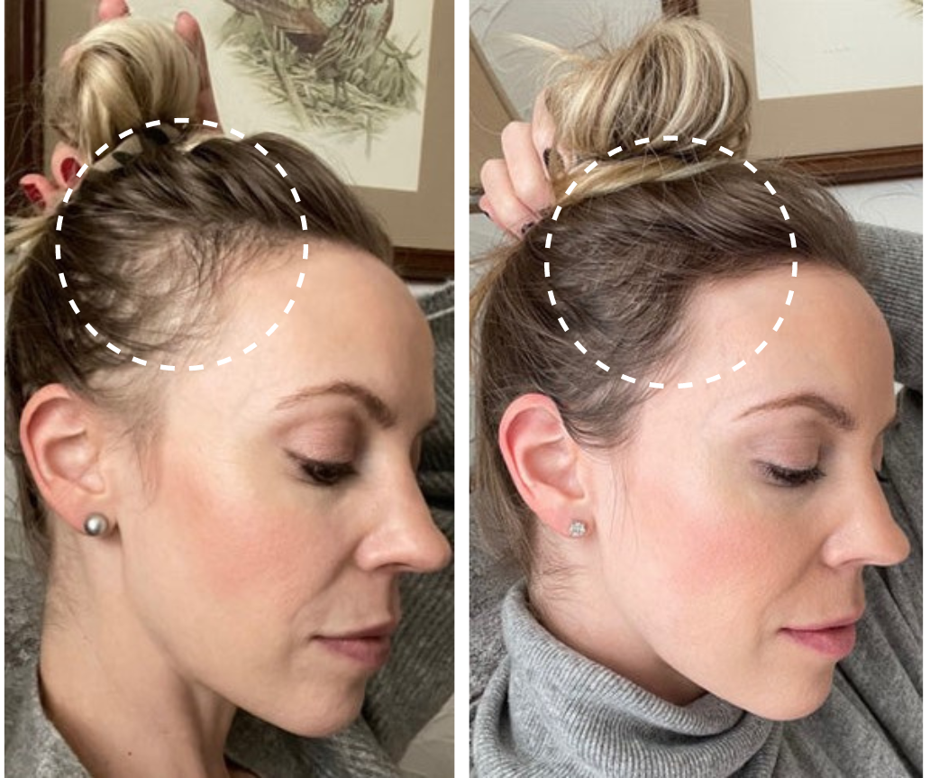 GrowEssence™ – Gezieltes Haarwuchs- & Kopfhautpflegeöl