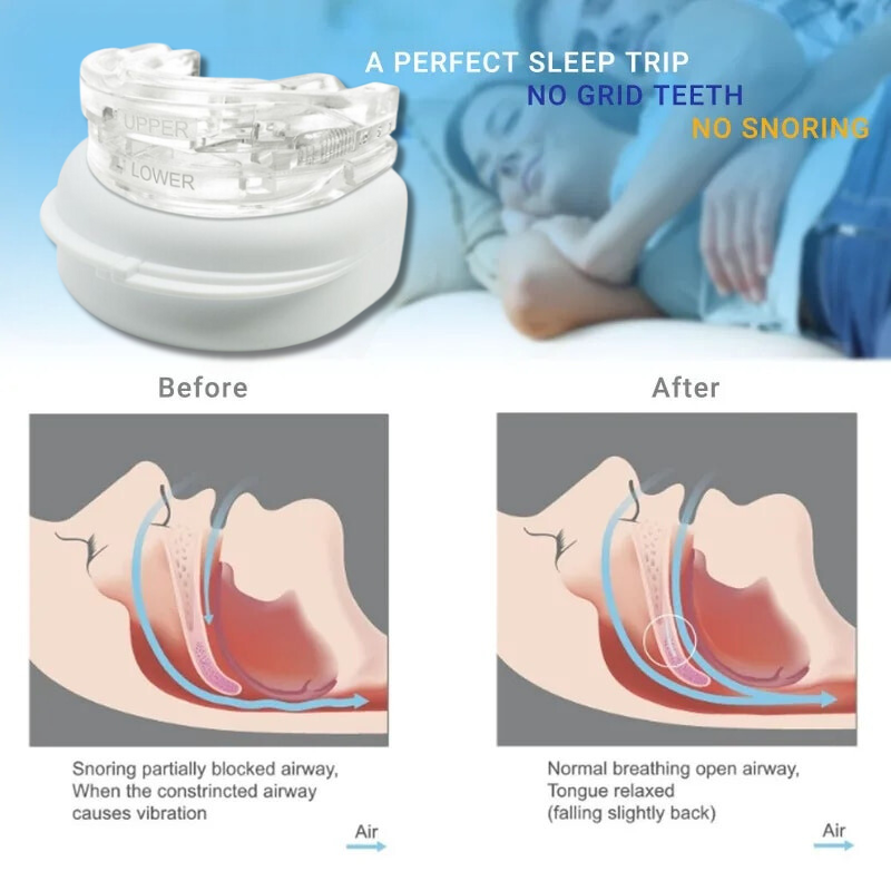 SnoreStop™ - Anti-Schnarch-Bruxismus-Mundschutz (50% RABATT)