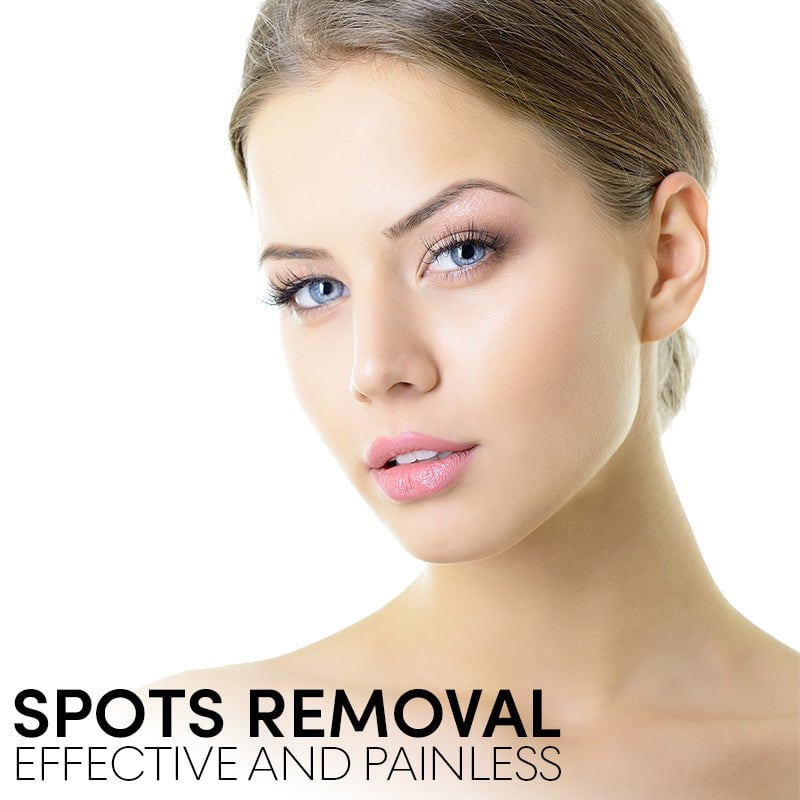 MoleOut™ - Spotfreier Elektrischer Beauty-Pen (50% RABATT)