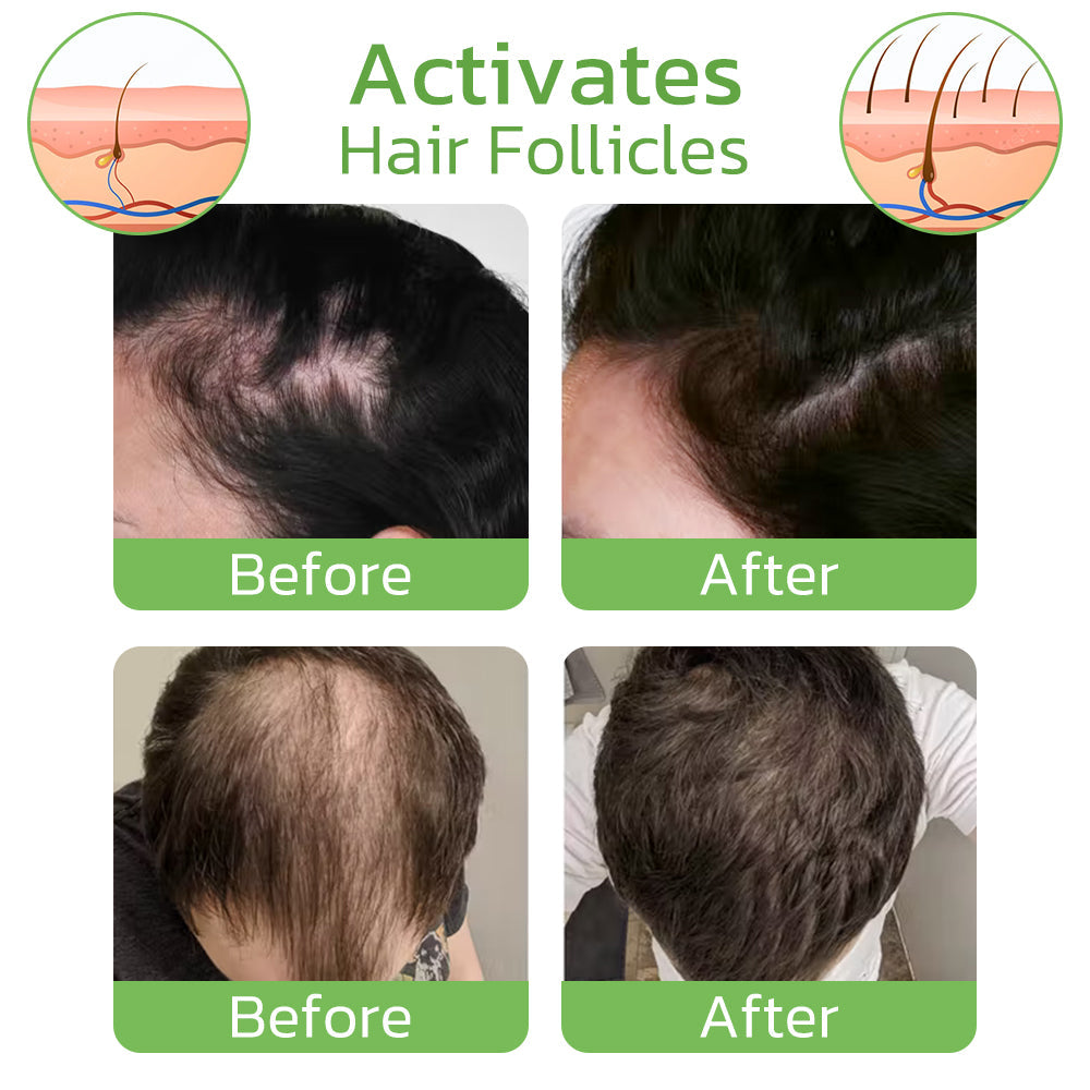 GrowthPlus™ - Nährendes Ingwer-Spray (50% RABATT)