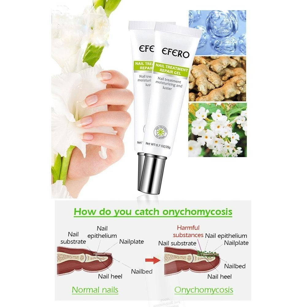 Nail Repair | Schnelle und effektive Ergebnisse! 1+1 GRATIS!